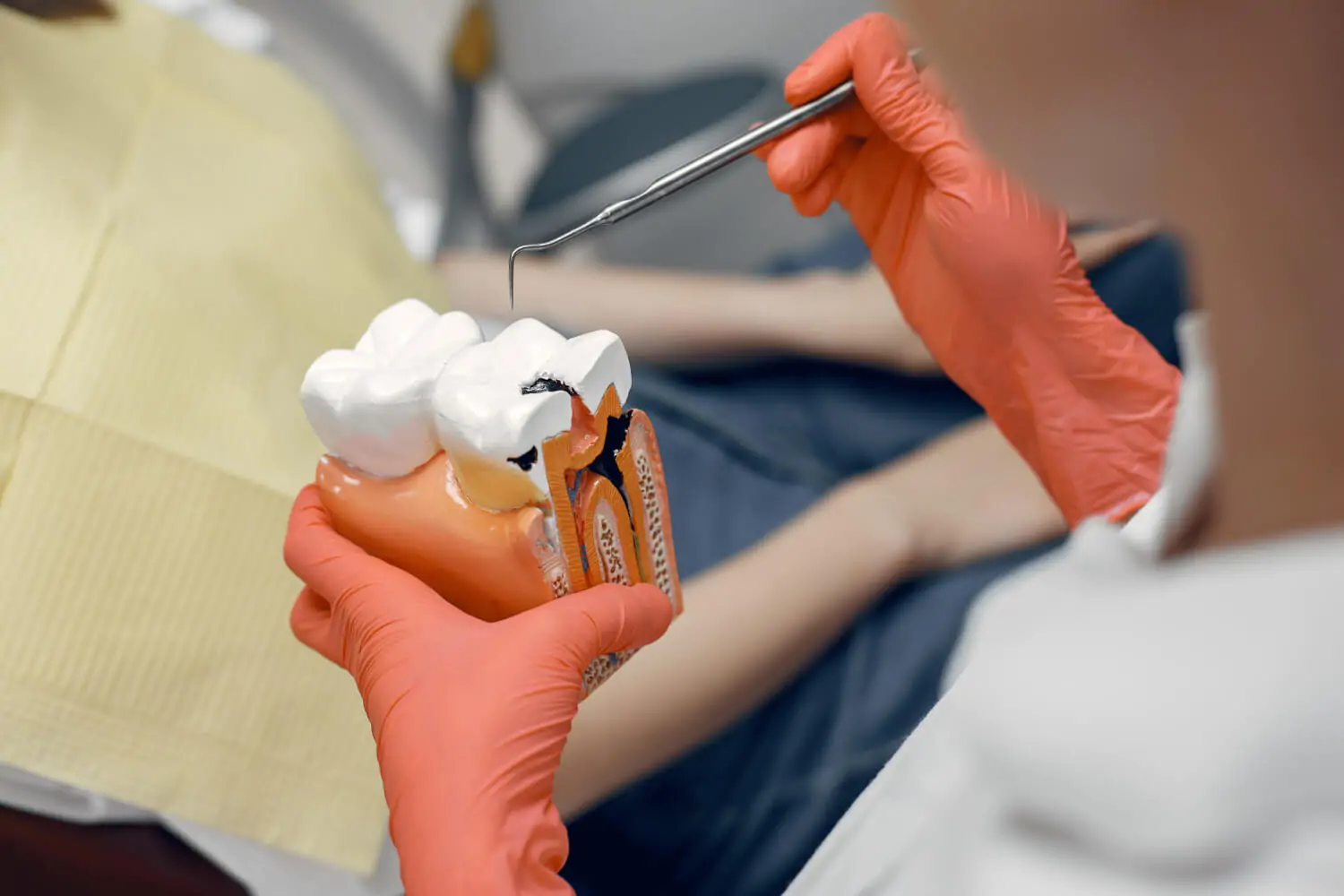Modelo anatômico de dente sendo analisado com instrumento odontológico na Ferdinand Odontologia, especialista em tratamento de canal na Tijuca, RJ